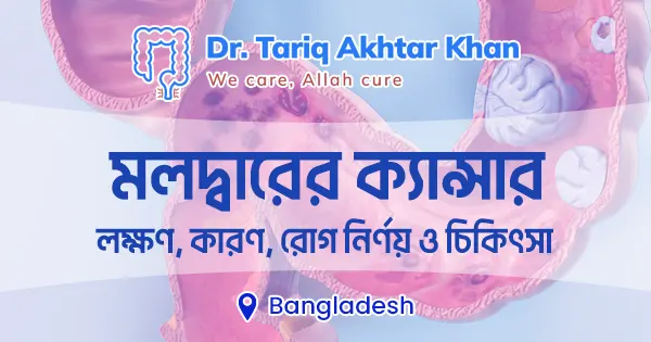 মলদ্বারের ক্যান্সার: লক্ষণ, কারণ, রোগ নির্ণয় ও চিকিৎসা
