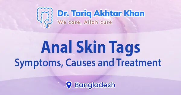 Anal Skin Tags: Symptoms, causes & treatment in Bangladesh