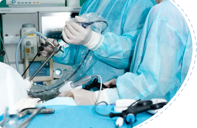 Anal stenosis diagnosis