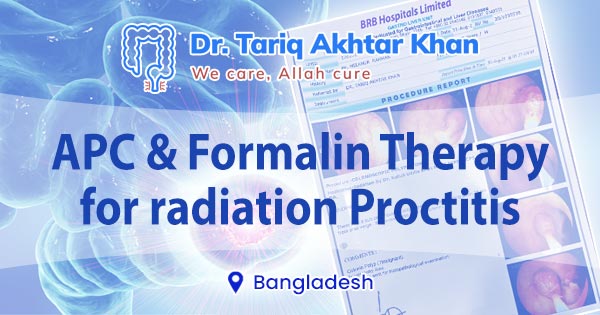 APC & Formalin therapy for radiation proctitis in Bangladesh