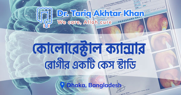 কোলোরেক্টাল ক্যান্সার রোগীর কেস স্টাডি: মিজানুর রহমান