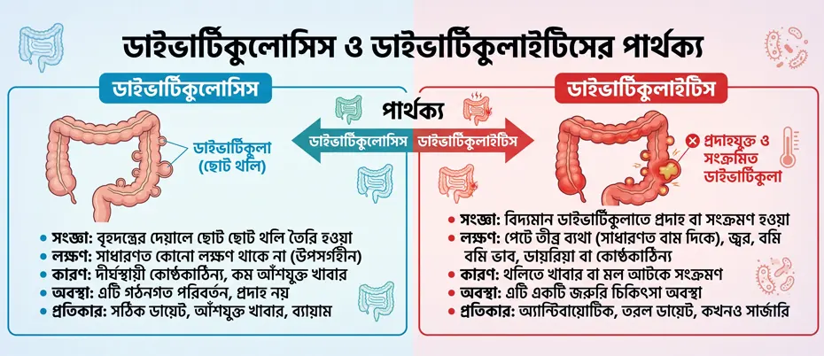 ডাইভার্টিকুলোসিস ও ডাইভার্টিকুলাইটিসের পার্থক্য