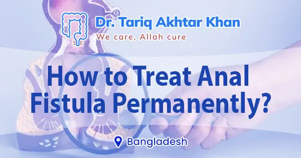 How to treat anal fistula permanently in Bangladesh?