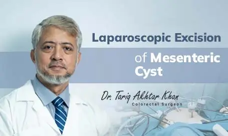Know about Laparoscopic excision of mesenteric cyst. Surgery by Dr. Tariq Akhtar Khan