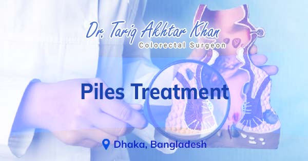 Piles treatment in Bangladesh | Dr. Tariq Akhtar Khan