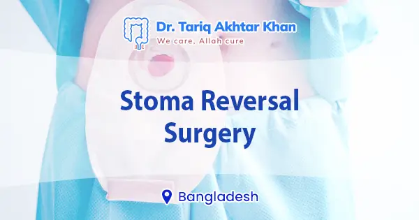 Stoma reversal surgery in Bangladesh | 