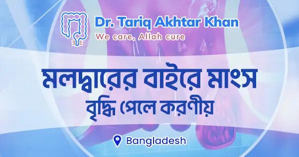 মলদ্বারের বাইরে মাংস বৃদ্ধি পেলে করণীয় 